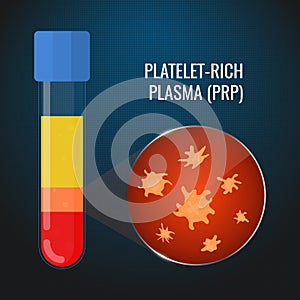 Close-up of PRP platelets in a test tube