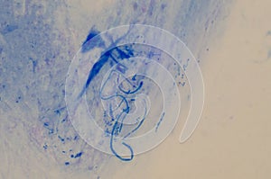 Pseudohyphae in gram stain method