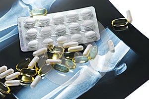 Close-up of X-ray image and different pills and capsules
