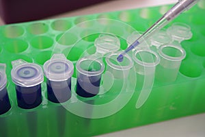 Close-up of reagent transfer with a pipette