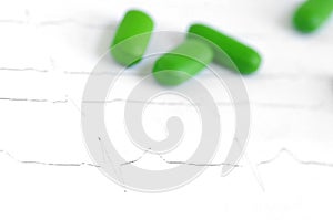 Close-up of real ecg graph