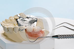 Removable partial denture RPD.