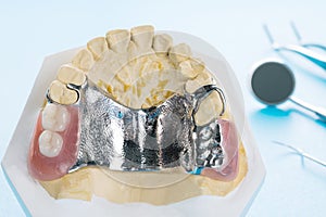 Removable partial denture RPD. photo