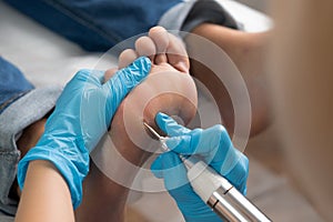 Close up removing a callus on a womans foot by electric drill photo
