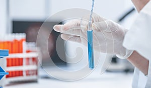 Close up. scientist testing test tubes with samples.