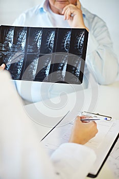 Close up of senior patient and doctor with x-ray