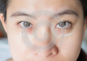 Close up shot of Asian woman face marking and applying anti aging cream on her under eyes.