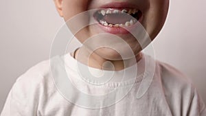 Close up shot of boy teeth. Health care, dental hygiene, dental problems, caries