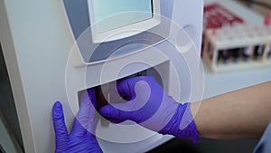 Close up shot of a doctor`s hand in rubber gloves, who conducts a general urine analysis on a modern medical device