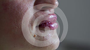 Close up shot of lips of young beauutiful wpman after botox injection. Extreme close up 4k shot