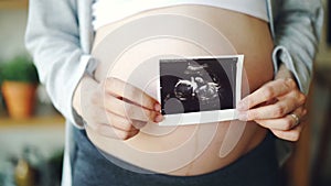 Close-up shot of pregnant woman`s belly and female hands holding ultrasound image of healthy unborn child. Pregnancy