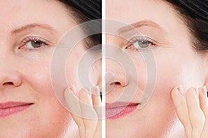 Close up before after skin Beauty middle age woman face portrait. Spa and anti aging concept Isolated on white background. Plastic