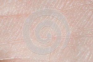 Close-up skin with sebaceous secretions on human leg, macro photo