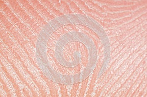 Close-up skin with sebaceous secretions on human leg, macro photo