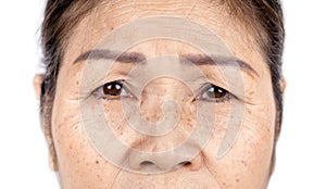 Close up skin wrinkle and freckles of old asian woman face