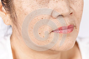Close up skin wrinkle and freckles of old asian woman face