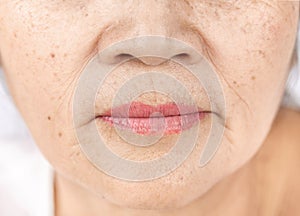 Close up skin wrinkle and freckles of old asian woman face