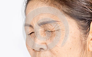 Close up skin wrinkle and freckles of old asian woman face which closing eyes