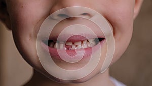 Close-up of a small boy showing his fallen baby tooth.