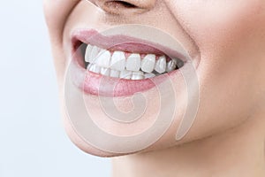 Close-up of smile with white healthy teeth.