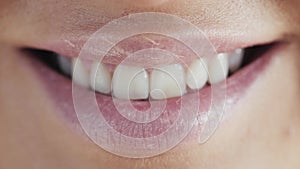 Close up of smile with white healthy teeth, fashion model clean smile with perfect teeth