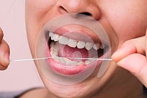 Close-up of smiling asian woman and cleaning for perfect smile. Healthy white teeth by flossing, oral health and dental care