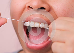 Close-up of smiling asian woman and cleaning for perfect smile. Healthy white teeth by flossing, oral health and dental care