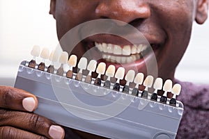 Man Matching The Shades Of The Teeth