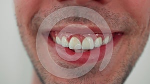 Close up of smiling teeth isolated. Detail of a smile bearded man. Young successful man is smiling on white background