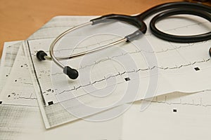 Close-up of a stethoscope on a printed graph of an EKG