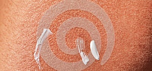 Close up of Sunscreen Protection or Sun Cream on human skin