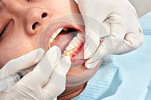 Close up teeth examination