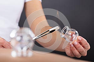 Therapist Giving Cupping Treatment photo