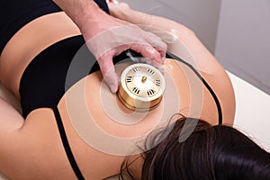 Close-up Of Therapist Placing Moxibustion Cans On Woman`s Back