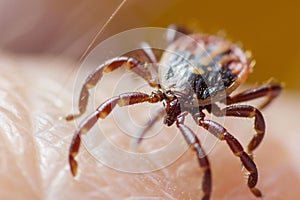 Close up of tick insect crawling on human skin