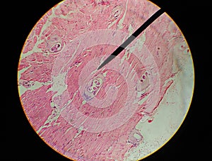 Close up Tissue parasit Trichinella spiralis. photo