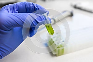 Close up to hands in blue gloves hold microtube with green liquid extract. Synthesis of new vaccine or drug against virus.