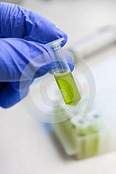 Close up to hands in blue gloves hold microtube with green liquid extract. Synthesis of new vaccine or drug against virus.