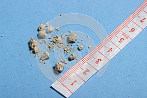 flat lay or top view very small kidney stones with ruler at blue background