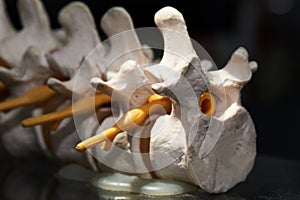 Close-up view of artificial human lumbar spine model