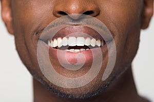 Close up view of beaming orthodontic white wide male smile