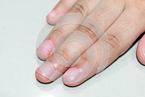 Close up view of Child`s Fingers and Finger Nails