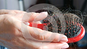 Close up view of female hands clean Drop down hair on a comb after combing. Lots of fallen hair on a comb. Hair loss