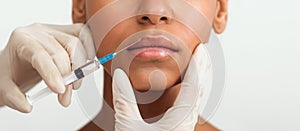 Close-up view of filler injection in lips