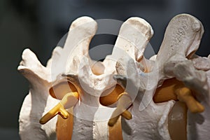 Close-up view of lumbar spine model