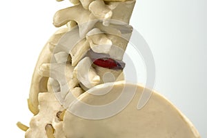 Close-up view of lumbar vertebra model