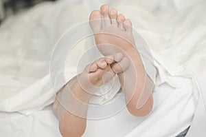 Close up view of men feet isolated on white sheet background laying on bed. Peeling flaky dry.