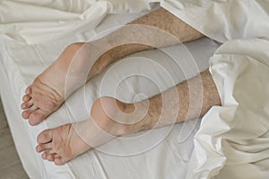 Close up view of men feet isolated on white sheet background laying on bed. Peeling flaky dry.