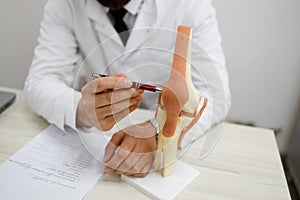 Close-up view of orthopedic doctor who demonstrates an artificial model of the knee joint.