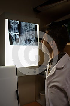 Close up view: picture of doctor exploring spinal x-ray